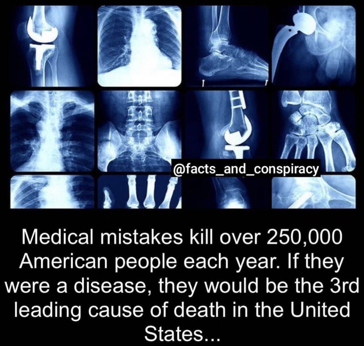 medical mistakes 250k killed each year doctors health.jpg